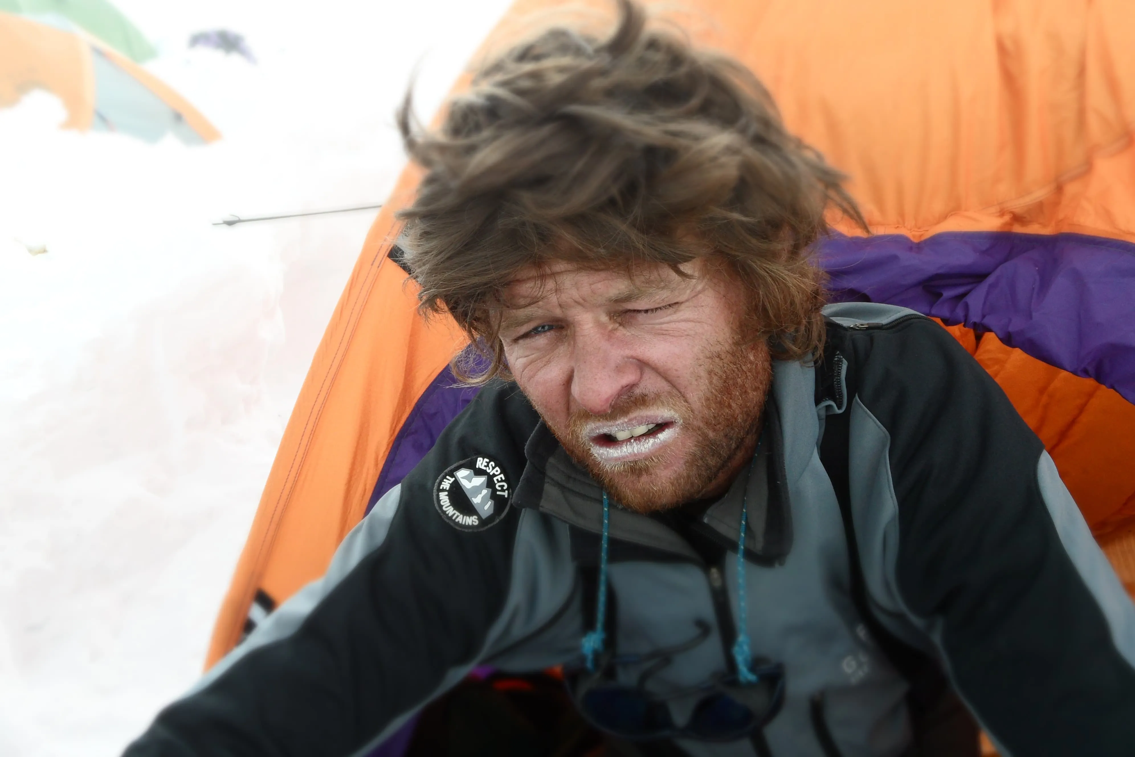 Symptoms of Altitude Sickness